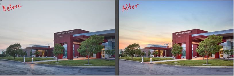 Orthoindy Hospital Before and After